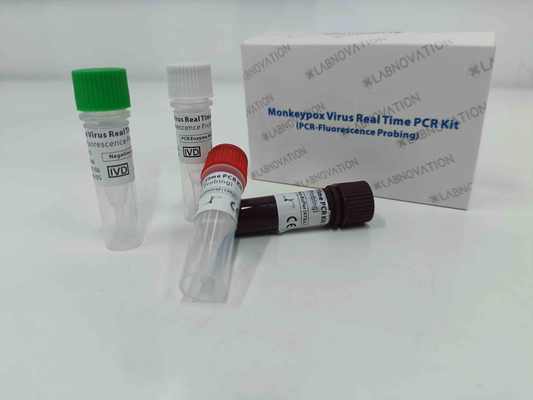 Muestras rápidas del exudado de la lesión del suero de Kit Real Time For Human de la prueba de la polimerización en cadena del virus de Monkeypox