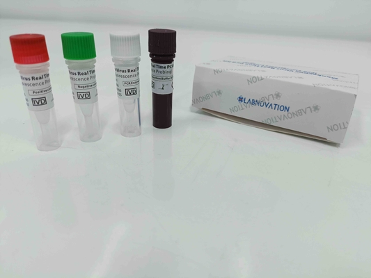 Prueba en tiempo real Kit With Positive/control negativo de la polimerización en cadena de Monkeypox