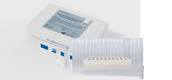 Pruebas rápidas Kit Immunochromatography Method del equipo 20 de la prueba del antígeno de Monkeypox